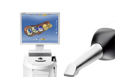 歯科専用の3D光学スキャナーを使った「セレック」